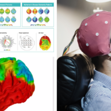 Brain map, male wearing a brain mapping cap