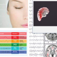 Identifying EEG Activity