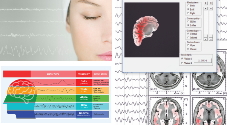 Identifying EEG Activity